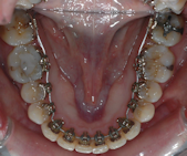 orthodontiste 93